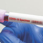 covid-19 specimen label test tube