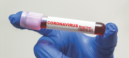 Coronavirus covid 19 test tube label